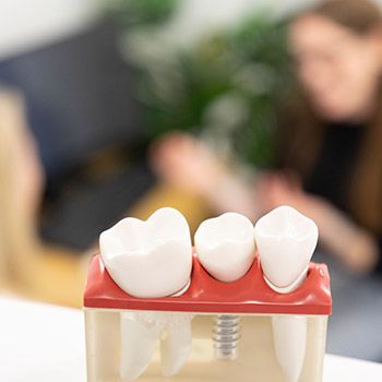dental implants - treatment